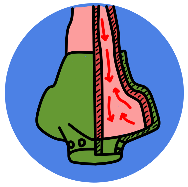 NASKA allows blood to circulate freely