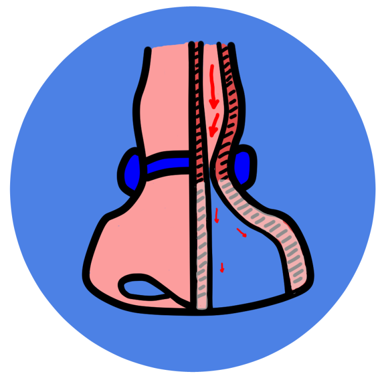 The nose clip reduces blood flow